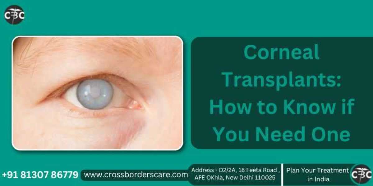 Corneal Transplants: How to Know if You Need One